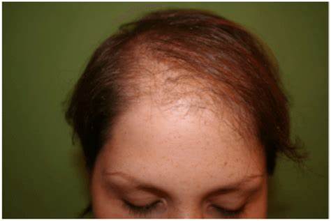 Formation : Fabrication Prothèse capillaire masculine et feminine - niveau 1