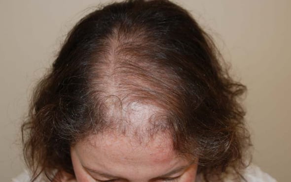 Formation : Fabrication Prothèse capillaire masculine et feminine - niveau 1