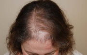 Formation : Fabrication Prothèse capillaire masculine et feminine - niveau 1